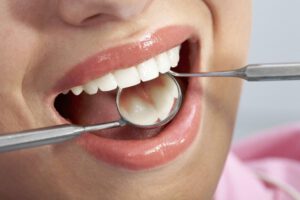 Rodzaje implantów zębowych - kluczowe informacje